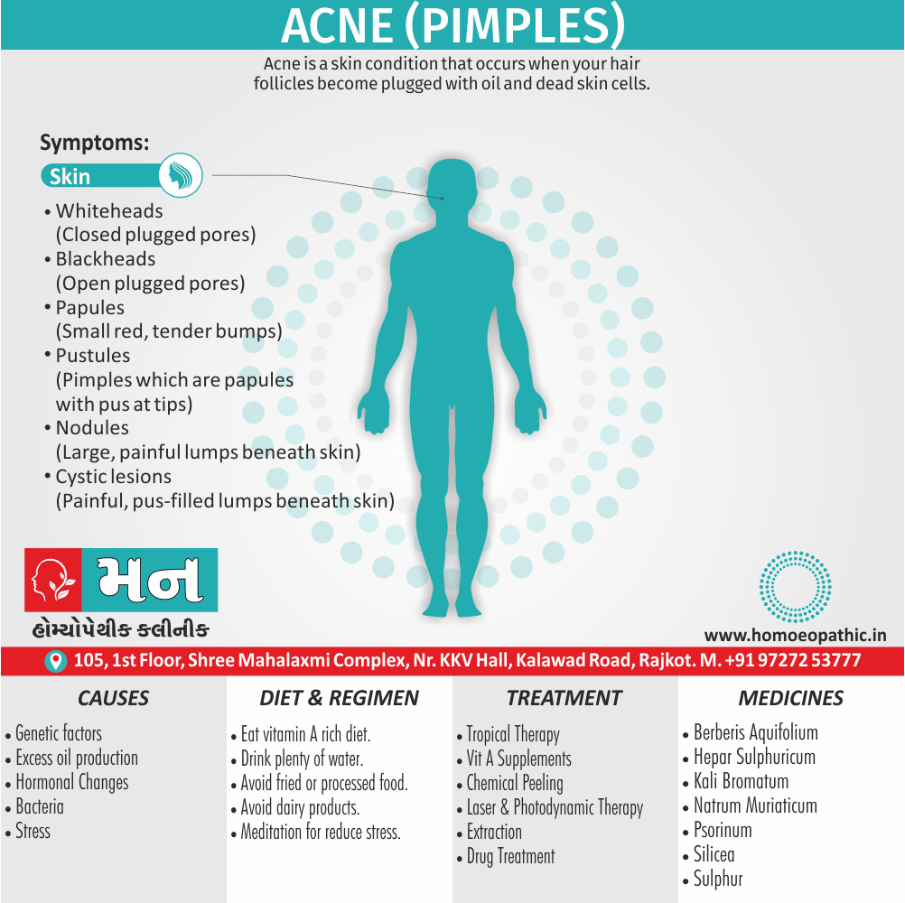 Acne Pimples Homeopathy Clinic In Rajkot